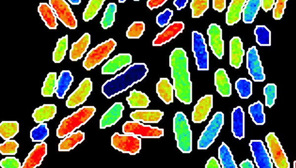 Cellules individuelles de K. oxytoca photographiées avec un NanoSIMS. L'image montre l'accumulation d'azote lourd (15N) dans les cellules après que la population a été alimentée avec de l'azote lourd moléculaire (15N2). (Copyright : Frank Schreiber)
