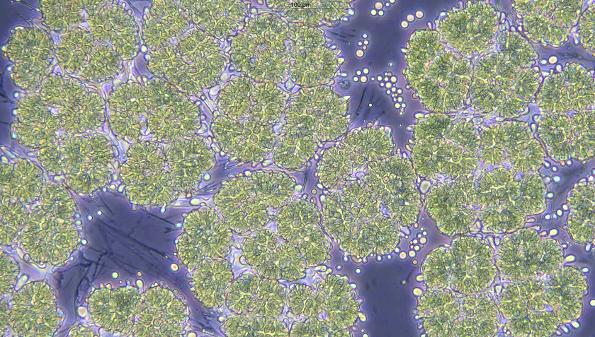 The microalgae Botryococcus braunii (pictured) protects other microalgae from pests (Photo: Eawag, Patrick Thomas).