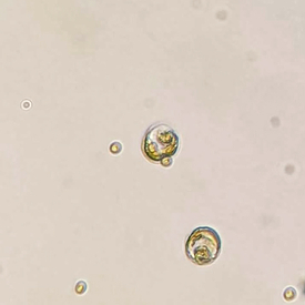 The flagellate P. malhamensis feeding on the small algae species N. limnetica. The cells of the flagellates are approximately 10 microns in diameter (Photo: Eawag, Patrick Thomas).