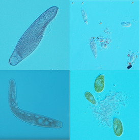 Images microscopiques des espèces de protistes étudiées (photos: Florian Altermatt)
