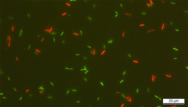 Darmbakterien Roseburia intestinalis eingefärbt mit SYBR Green und Propidiumiodid (SGPI). (Foto: ETH Zürich, Lea Bircher)